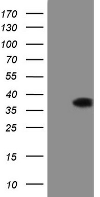 CDC42 binding protein kinase alpha Antibody