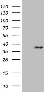 CDC42 binding protein kinase alpha Antibody