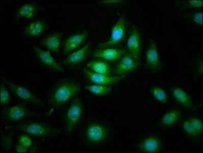 CDC42BPB Antibody