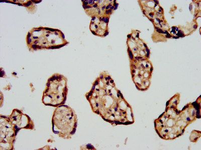 CDC42BPB Antibody