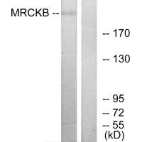 CDC42BPB antibody