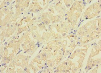 CDC42EP2 Antibody