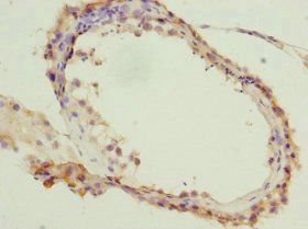 CDC7 Antibody