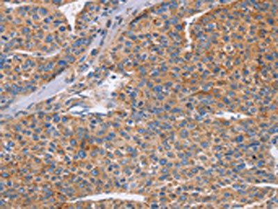 CDC7 Antibody