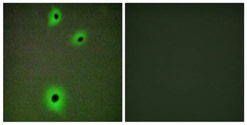 CADM4 Antibody