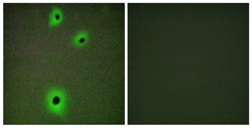 CDCA7 antibody