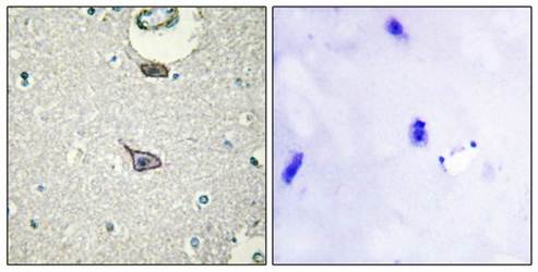 CADM4 Antibody