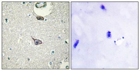 CDCA7 antibody