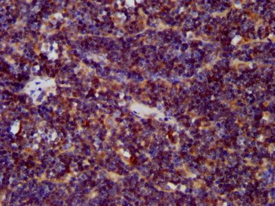 CDCA7L Antibody