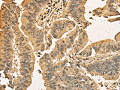 CDCA8 Antibody