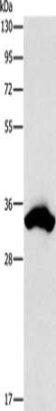 CDCA8 Antibody