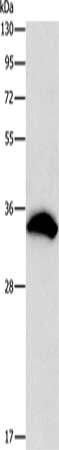 CDCA8 antibody