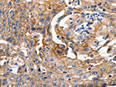 CDH1 Antibody