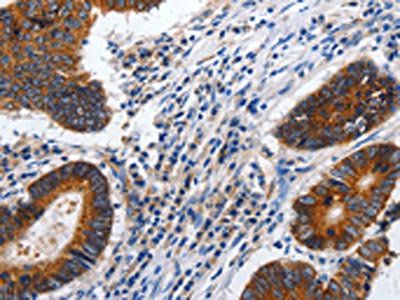CDH1 Antibody