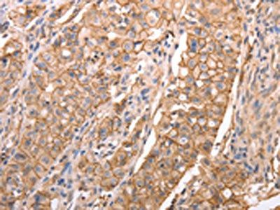CDH1 Antibody