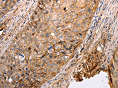 CDH1 Antibody