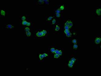 CDH1 Monoclonal Antibody