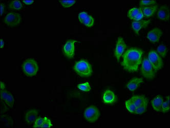 CDH1 Monoclonal Antibody