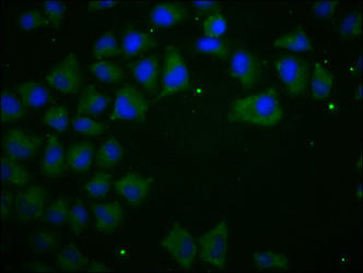 CDH1 Monoclonal Antibody