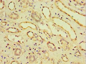 CDH11 antibody