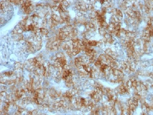 Ksp-Cadherin (Kidney-Specific Cadherin) / CDH16 Antibody
