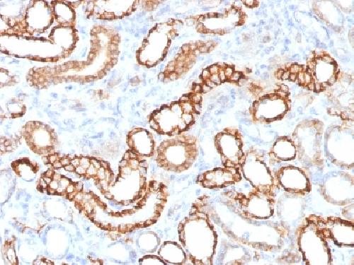 Recombinant Ksp-Cadherin (Kidney-Specific Cadherin) / CDH16 Antibody