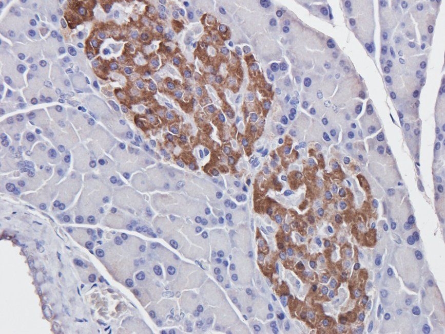 CDH17 antibody