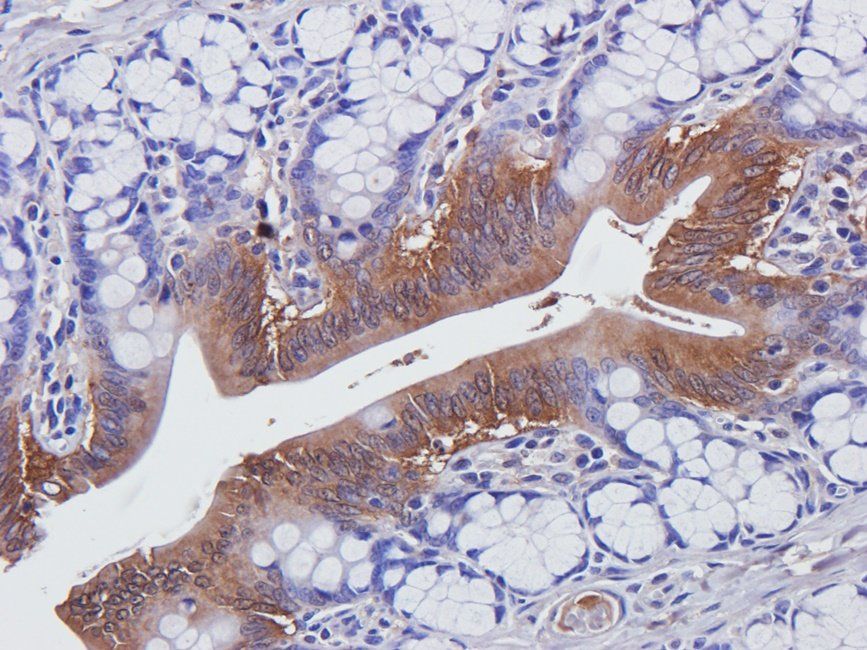 CDH17 antibody