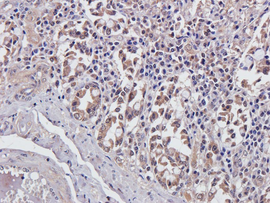 CDH17 antibody