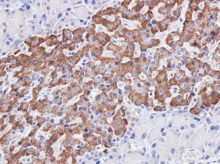 CDH17 antibody