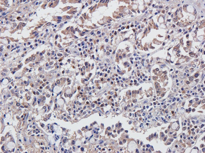 CDH17 antibody