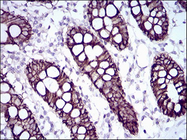 CDH17 Antibody