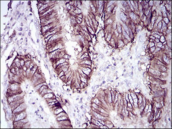 CDH17 Antibody