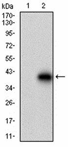 CDH17 Antibody