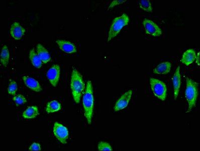 CDH18 antibody