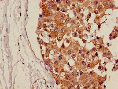 CDH18 Antibody