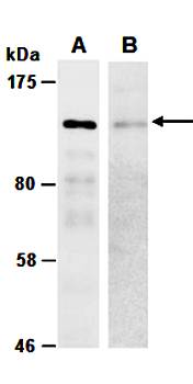 CDH1 (C) Antibody, Rabbit Polyclonal
