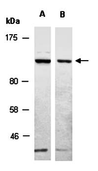 CDH1 (C2) Antibody, Rabbit Polyclonal