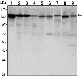 CDH1 Antibody