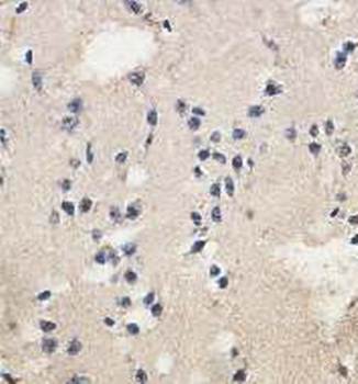 ECAD Rabbit Polyclonal Antibody