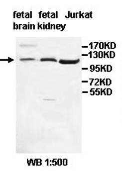 ECAD Rabbit Polyclonal Antibody