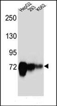 CDH22 antibody