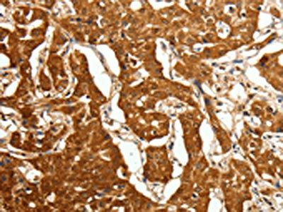 CDH23 Antibody