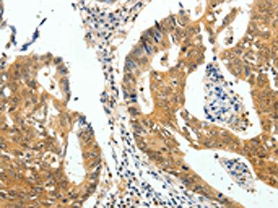 CDH23 antibody