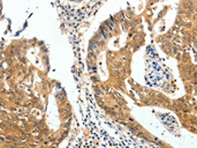 CDH23 Antibody