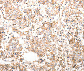 CDH23 antibody