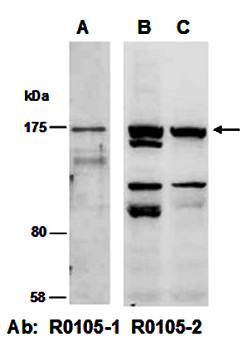 CDH2 (M) Antibody, Rabbit Polyclonal