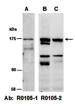 CDH2 (C) Antibody, Rabbit Polyclonal