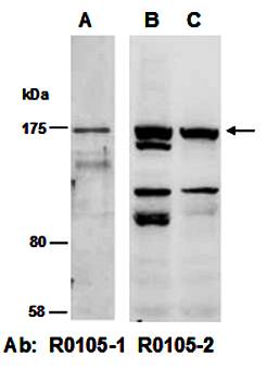 CDH2 (vPairTM) Antibodies