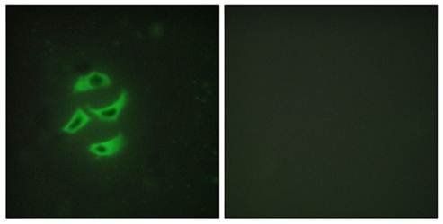 Cytochrome P450 2J2 Antibody